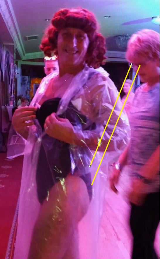 Johnny 2 Step getting his but checked out!